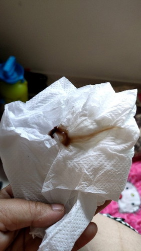 มีมูกเลือดออก