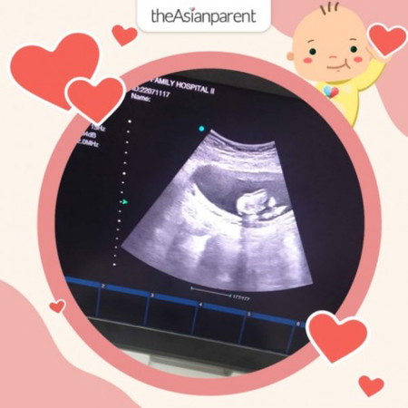 Gender reveal.