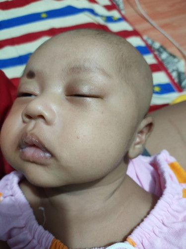 ลูกเป็นแบบนี้ต้องไปหาหมอไหมคะ?