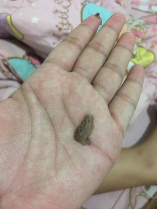 สอบถามค่ะ ท้องได้40+2