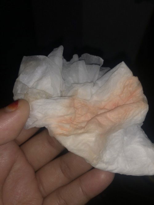 Ketuban apa bukan ya