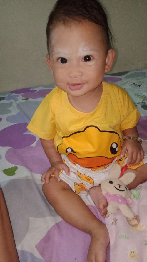 Berat badan bayi susah naik