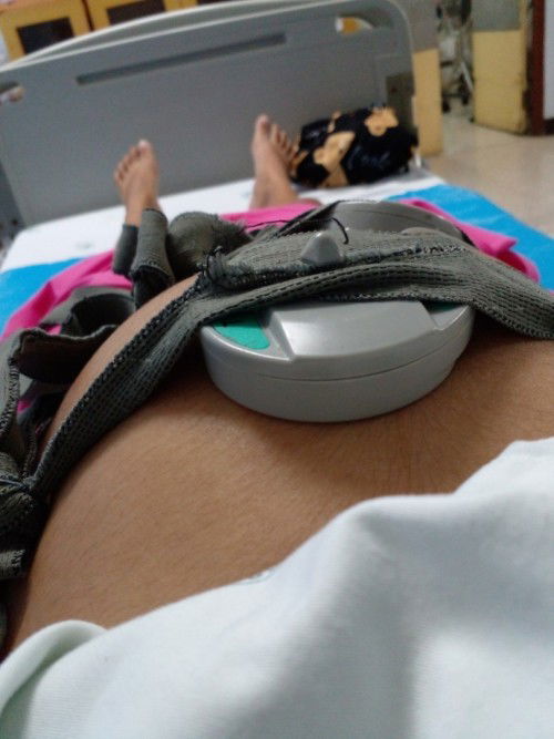 38+3 ใกล้แตกแล้วค่ะ รอคลอด มดลูกเปิด5ซ อาการมีมูกเลือดตอนตีห้าหกโมงเริ่มเจ้บท้องแต่ไม่ถี่