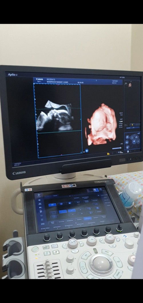 28week   ทำ3D 4D