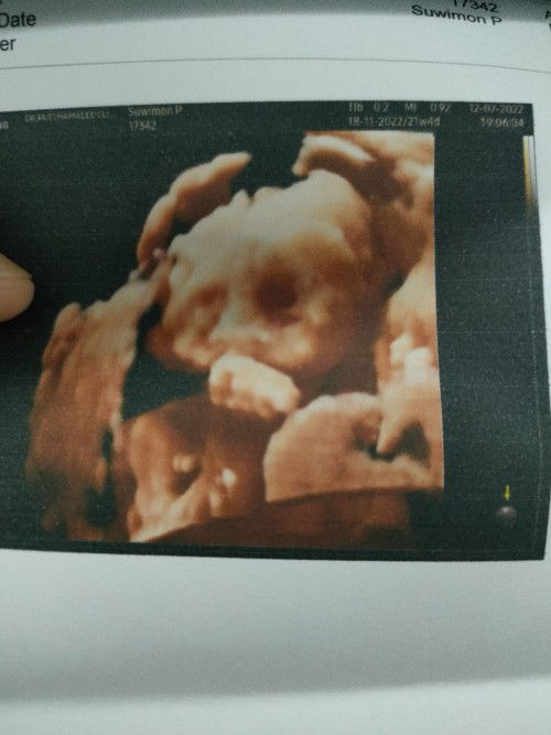 ตรวจเชิงลึก 21+5