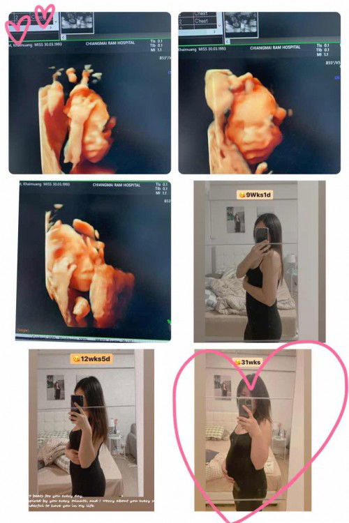 ตื่นเต้นมากคะจะได้เจอน้องวันศุกร์นี้แล้ว