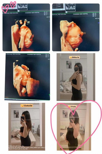 ตื่นเต้นมากคะจะได้เจอน้องวันศุกร์นี้แล้ว