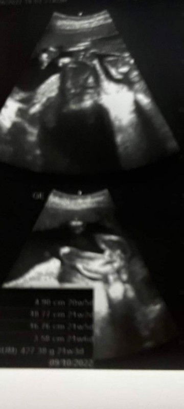 อยากถามแม่ๆหน่อยค่ะแบบนี้หยิงหรือชายคะแต่คุณหมอบอกหญิง90%ค่ะแอบลุ้นค่ะ เพราะได้ชายแล้วคนนึง