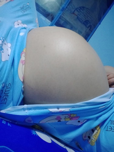 38weekแล้วค่ะยังเงียบอยู่เลยค่ะแต่น้ำมูกจากใสเปนขุ่นแบบนี้ผิดปกติไหมหรือเปนสัญญาณเตือนคลอด
ลูคนแรกค่