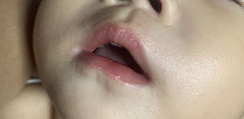 รบกวนสอบถามหน่อยค้า น้องปากแดงผิดปกติ ละเหมือนมีผื่นที่ปาก