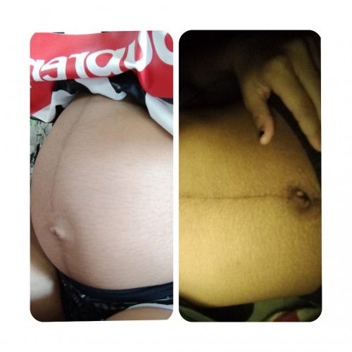 ตอนท้อง&หลังคลอด