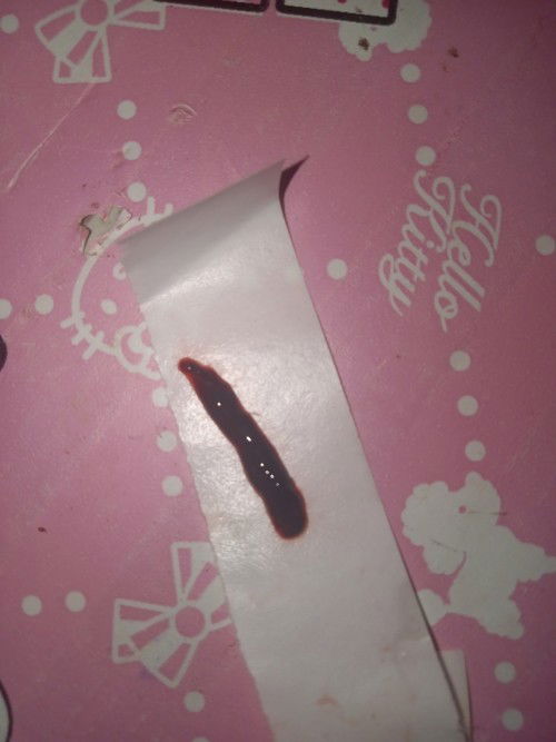 Spotting and sac syndrome