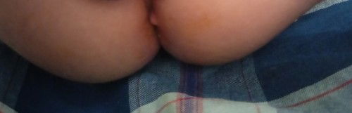 Bisul di dekat anus, bayi 3 bulan