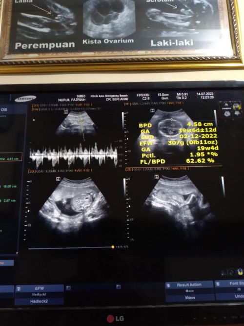 Curhat tipis2 ya bun