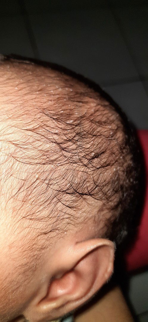 Bintik bintik putih .