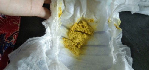 เด็ก 1 เดือน