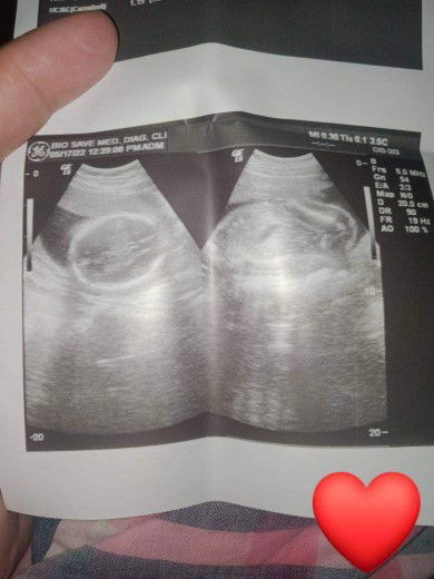 Baka po may alam kayo kung paano po sya tignan 🙂