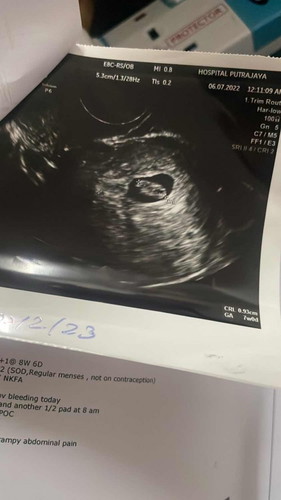 SCAN 9W tapi baby 7w 🥹