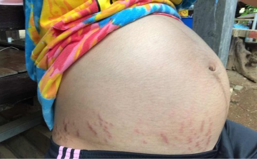 แม่ๆบ้านไหนแตกลายเหมือนกันไหมคะ