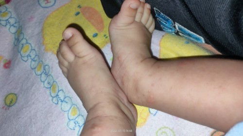 Bintik" seperti berair