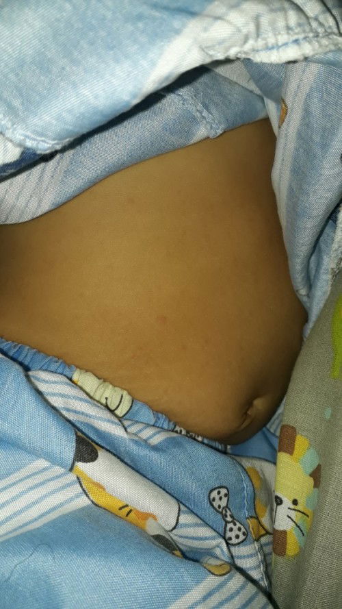 Muncul keringat dingin setelah demam 2 hari