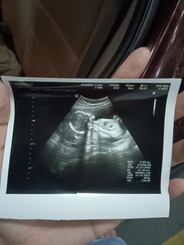 17 วีค 4 วัน ลุ้นเพศ