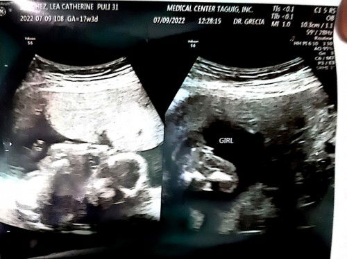 GENDER...is it a girl talaga??