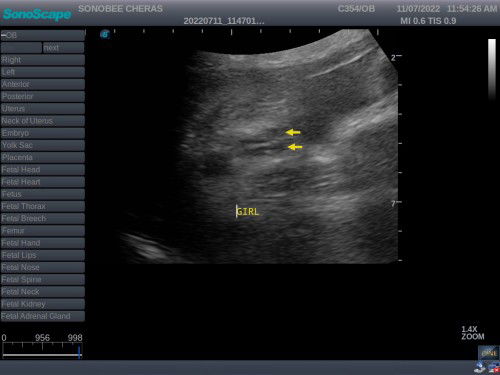 confirm gender girl ke macam ni