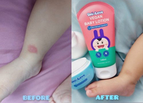UNI-LOVE VEGAN BABY LOTION & UNI-LOVE VEGAN BABY CREAM