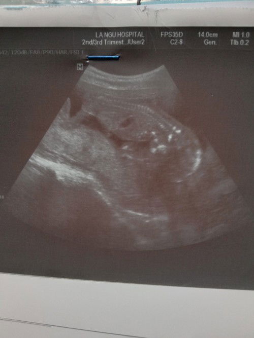 การตั้งครรภ์