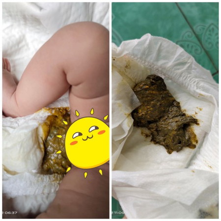 การขับถ่ายลูก