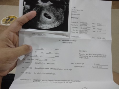 6 weeks pregnancy