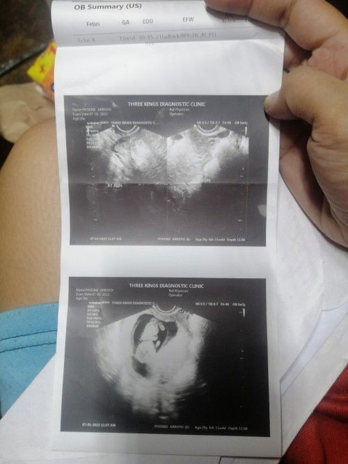 Anong naging pakiramdam nyo nung nalaman nyong buntis kayo?