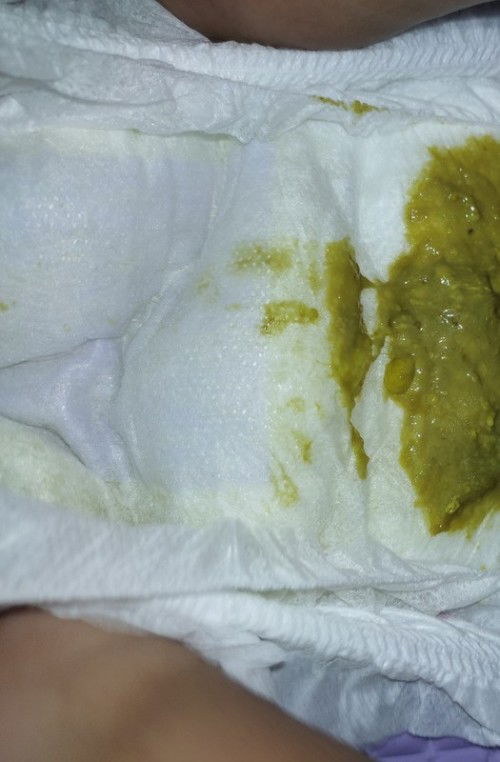 Maaf kotor sikit tunjuk taik anak nak tnya anak siapa pernh jadi macm ni?