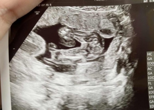 Hampir 19 weeks