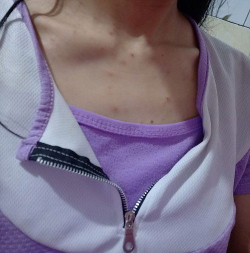 Ini Kenapa Ya Hamil 22 Minggu Badan Pada Gatel Begini