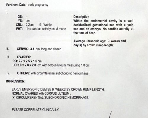 EMBRYONIC DEMISE🥺😭💔