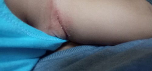 Hi,Ano po kaya puwede ipahid sa kilikili ni baby?