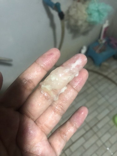 38 วีคแล้วมีแบบนี้ออกมาต้องไปหาหมอไหมคะ
