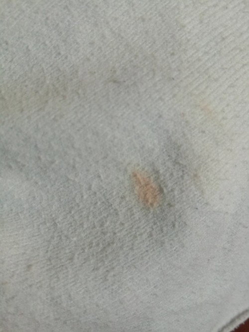 normal ba kulay ng ihi ni baby ay parang orange? sino po nakapansin?