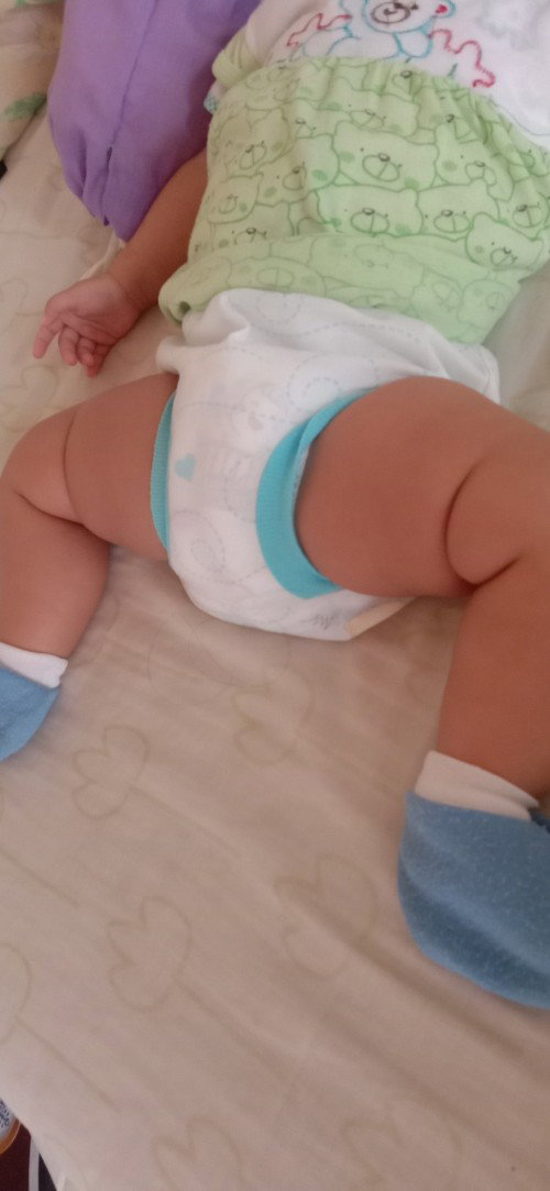 Kaki bayi apa kah normal?