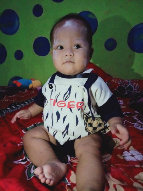 . Bayiku umur 9bulan, tapi dia belum bisa merangkak, giginya sudah tumbuh 2😁
