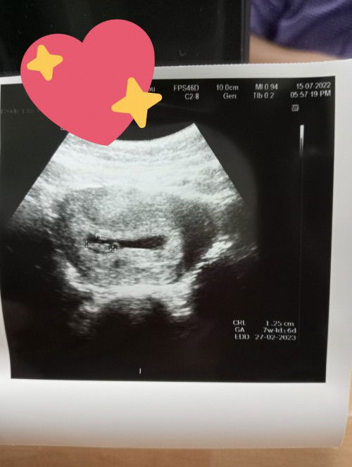 Usg tapi ga di jelasin itu embrio atau udah janin.