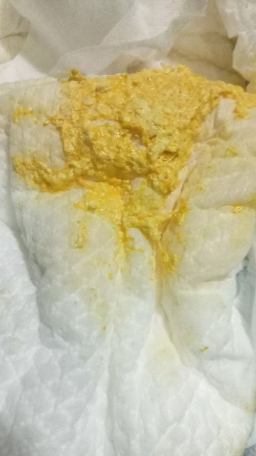 Pup anak saya kuning seperti ini apah normal atau tidak?