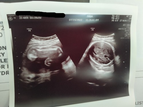 27weeks na po ako hindi ko parin po alam gender ni baby