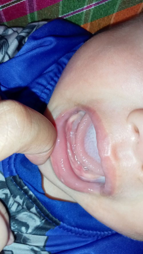 ฟันน้องจะขึ้นหรืออะไรคะ?