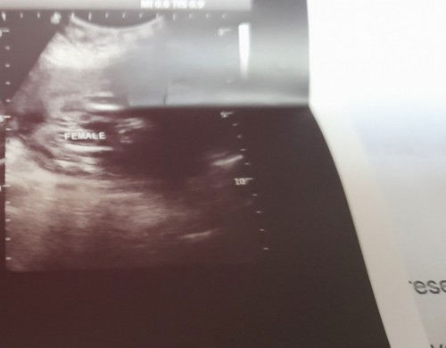 sure na po kaya na girl si baby?