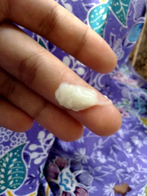 มีแบบนี้ออกทางช่องคลอดค่ะมา2วันแล้ว