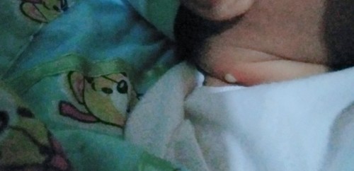 Tanong lang po ano po kaya tong nasa leeg ni baby