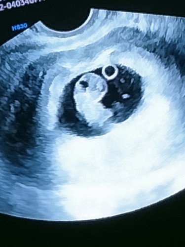 8 weeks pregnant!